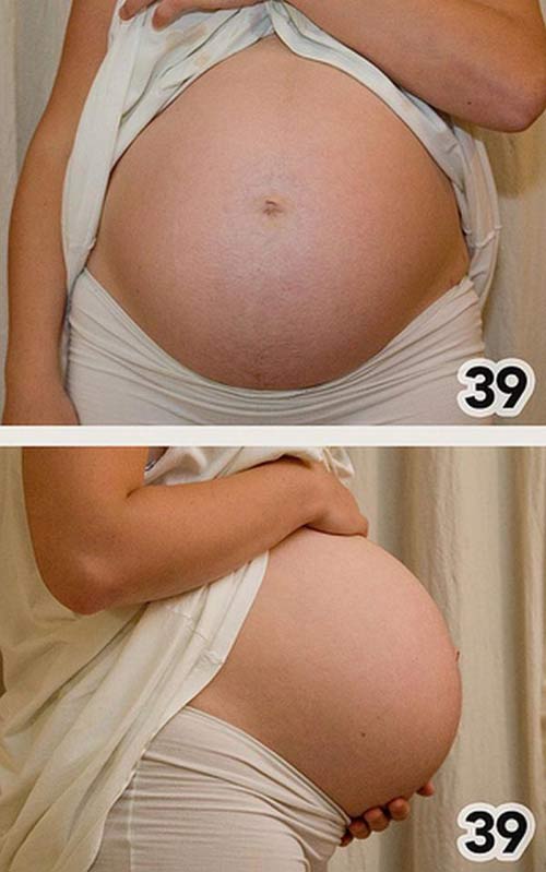 Embarazo de 39 semanas