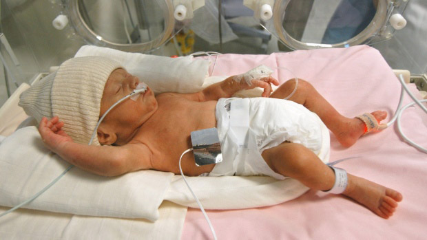 El bebé en incubadora