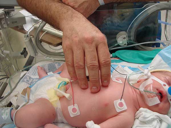 La neonatologia