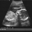Semana 22 de embarazo