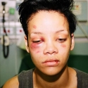 Rihanna tras la gopliza dada por Chris Brown