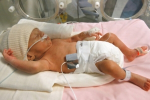 El bebé en incubadora