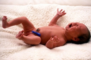 Lesión del plexo braquial en recién nacidos