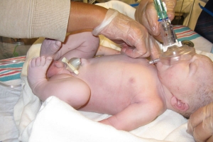 Dificultad respiratoria neonatal