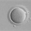 Fecundacion in vitro